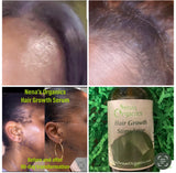 Hair Growth Stimulator